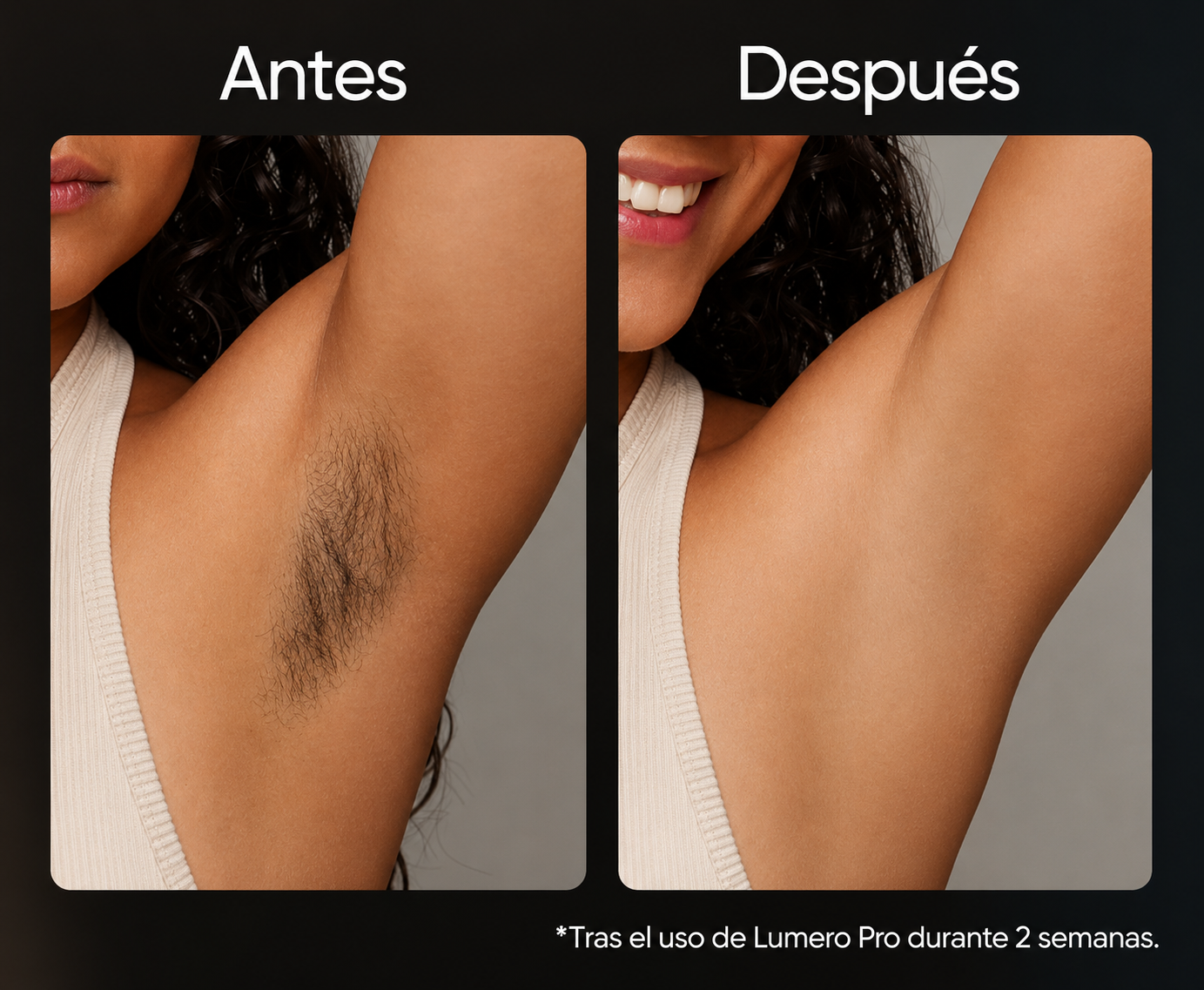 Lumero Pro™ | Laser Permanente